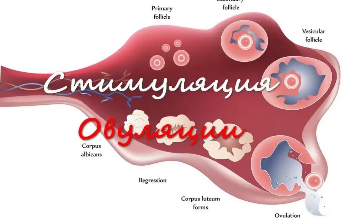 Стимуляция овуляции яичников